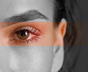 An In-Depth Look at Sore Eyes: Causes, Symptoms, and Treatments