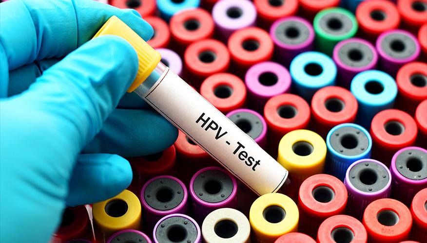 HPV testing