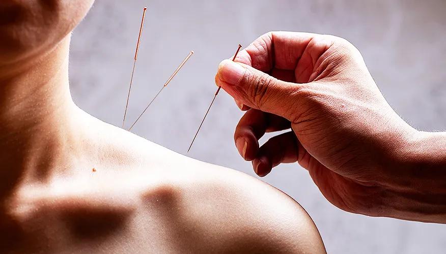 Other TCM modalities for muscle pain relief