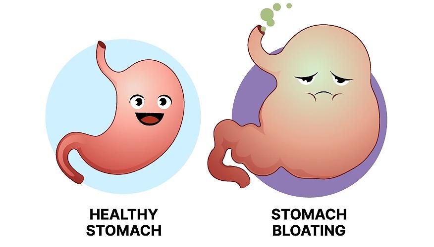 Illustration showing healthy stomach and bloated stomach