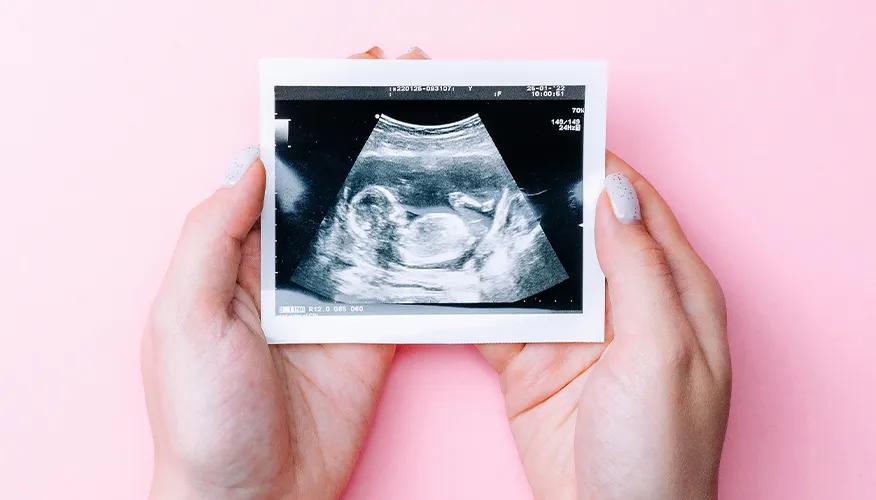 Ultrasound