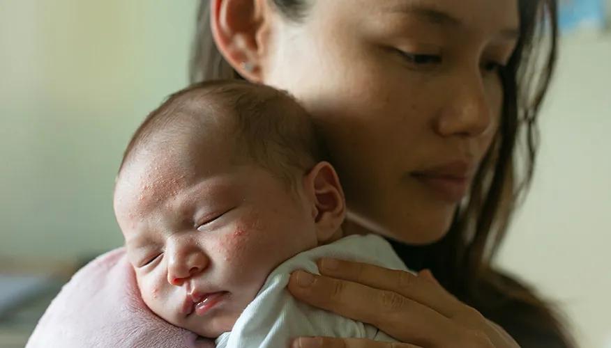 When To Seek Medical Assistance For Baby Acne?