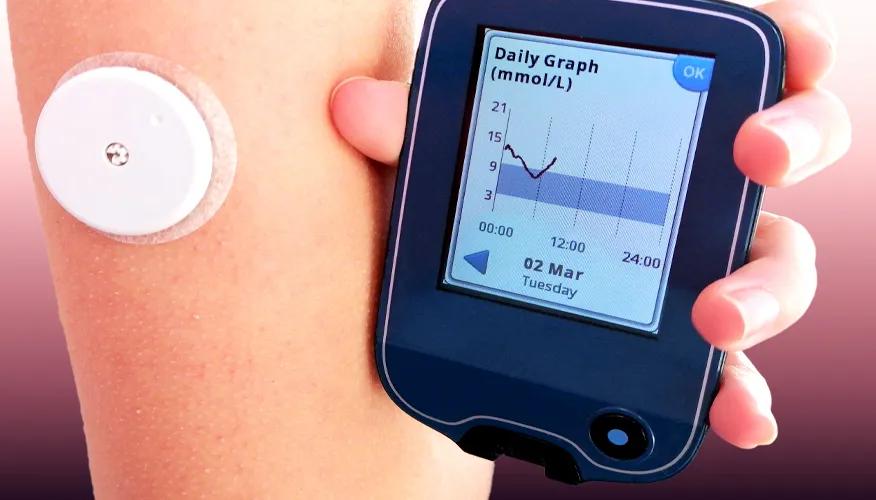 Continuous Glucose Monitoring: Making sense of blood sugar levels