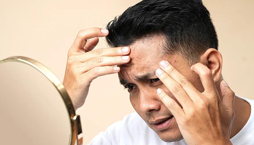 What Should Be Done to Avoid Skin Issues Brought on by Diabetes