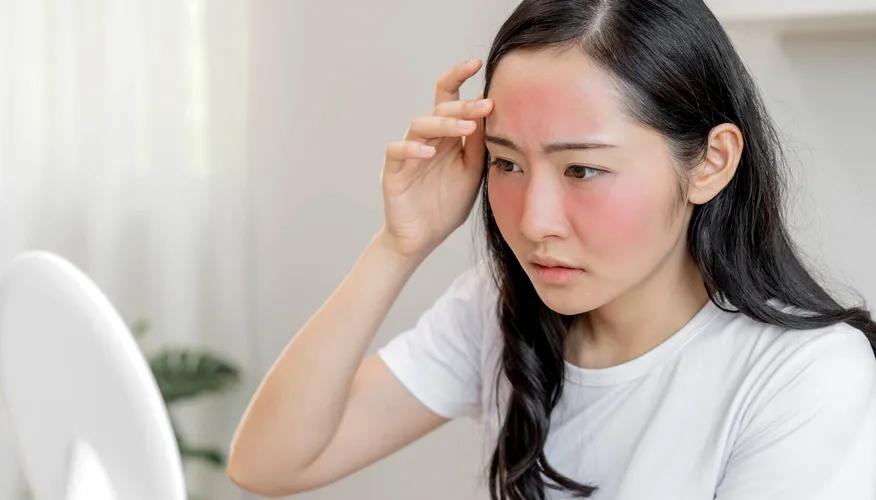 Increased skin sensitivity