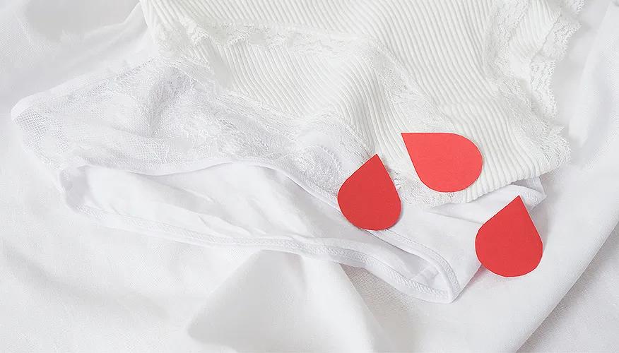 When should you be concerned about intermenstrual bleeding?