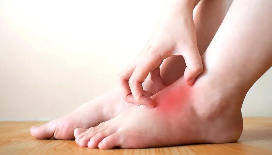 Skin Conditions – One of the Most Typical Indications of Diabetes