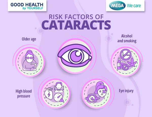 Risk factors of cataract