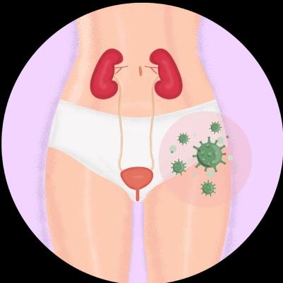 Infection Prevention