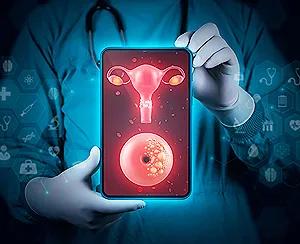 how to prevent cervical cancer