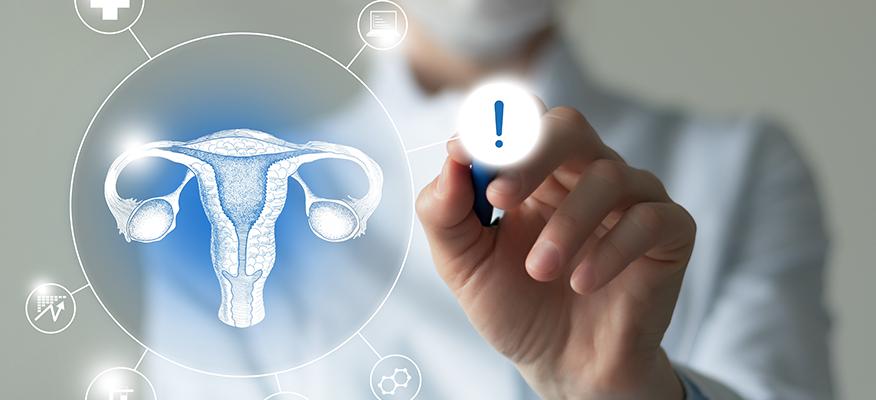 Signs Of Cervical Cancer