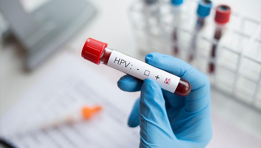 5 things every woman should know about HPV