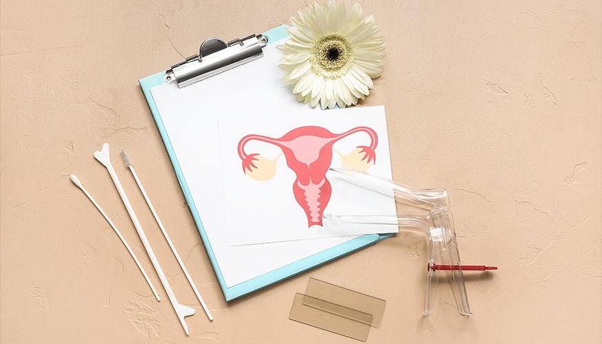 Can I prevent cervical cancer?