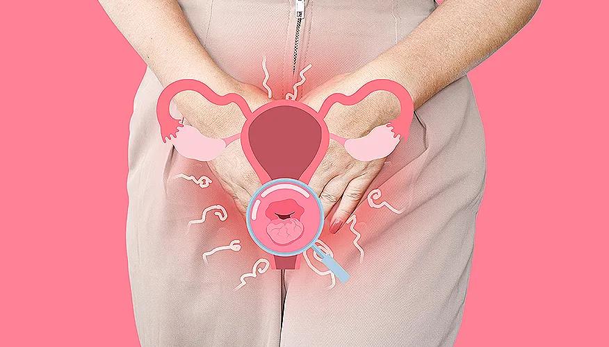 What is vaginal discharge?