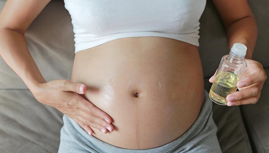 How To Prevent Stretch Marks During Pregnancy?