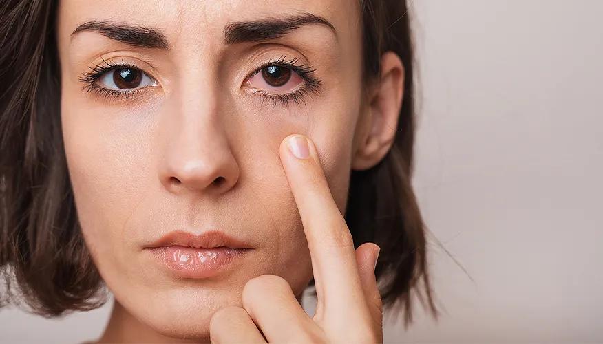 Understanding sore eyes