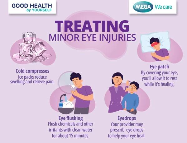 Treating minor eye injuries