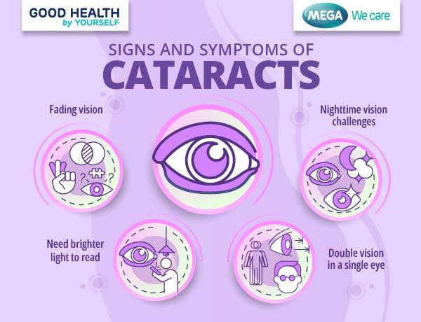Signs and symptoms of cataracts